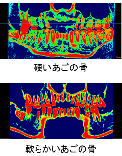 ct05.png